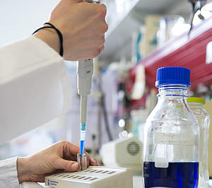 profiles teaser www-biochemie-b-5921_28.jpg